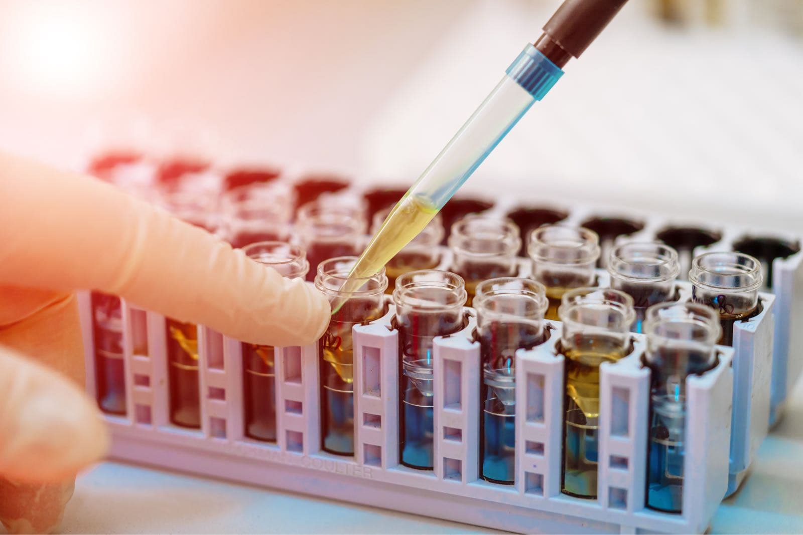 Transforming the Detection of Minimal Residual Disease (MRD) with Single-cell DNA Analysis
