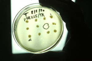 Photo of bacterial culture in a recombinant DNA experiment